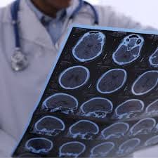 Neurology Department