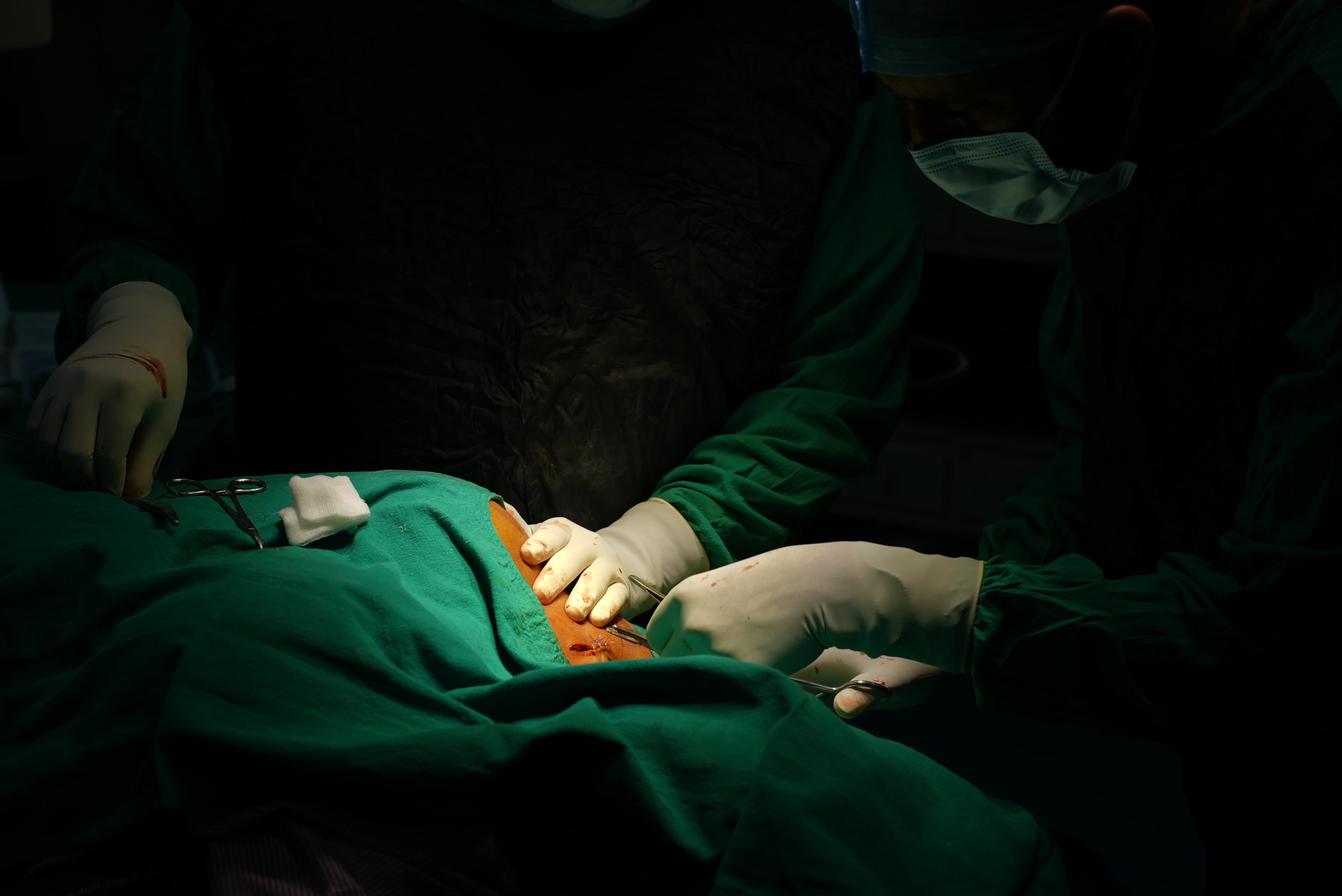 Surgical Oncology Department